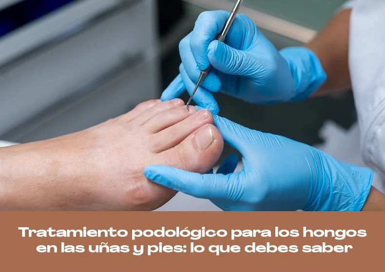 Tratamiento podológico para los hongos en las uñas y pies: lo que debes saber