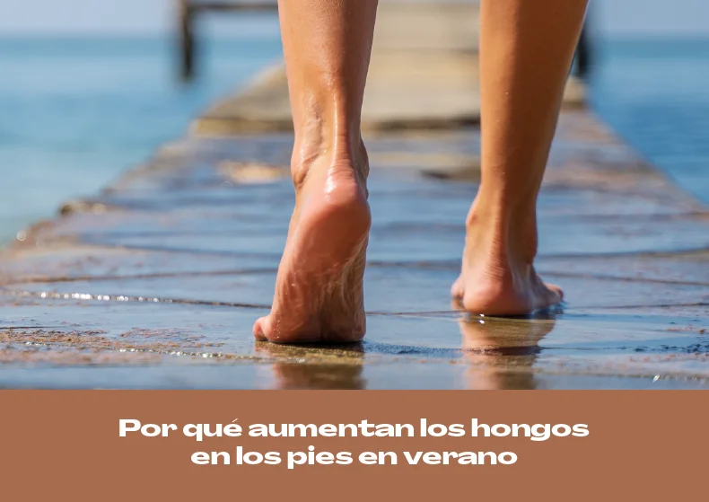 ¿Por qué aumentan los hongos en los pies en verano?