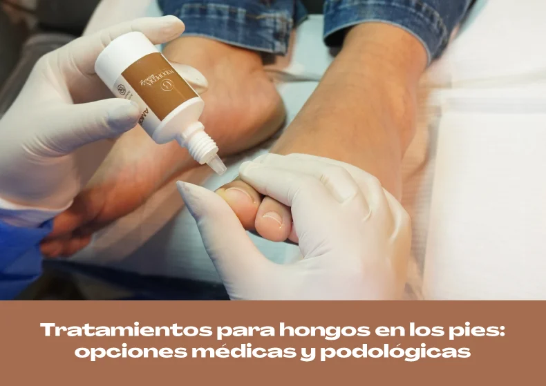 Tratamientos para hongos en los pies: opciones médicas y podológicas