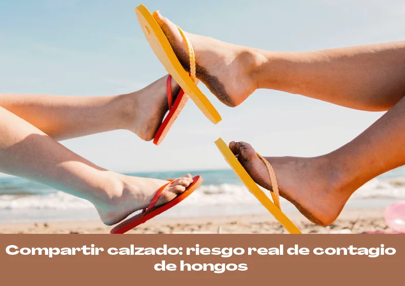 Compartir calzado: riesgo real de contagio de hongos