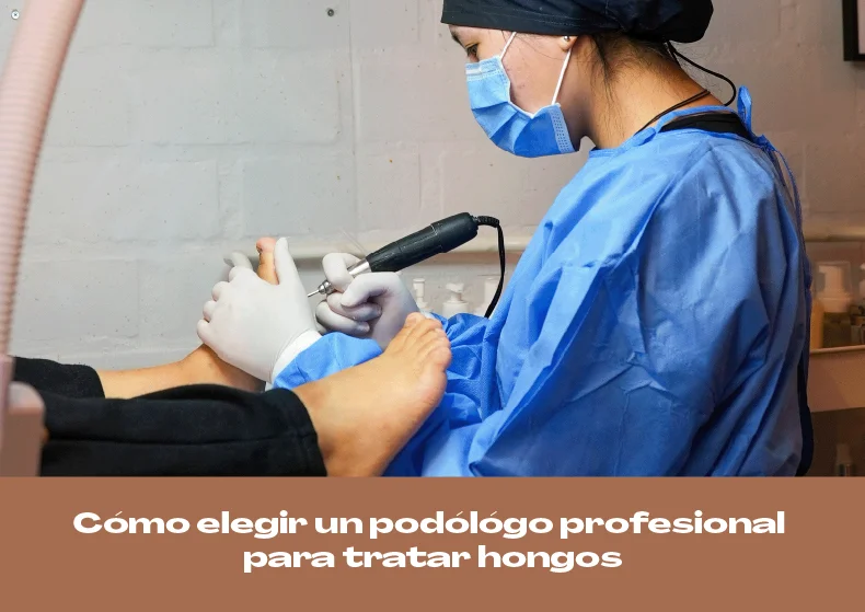 Cómo elegir un podólogo profesional para tratar hongos