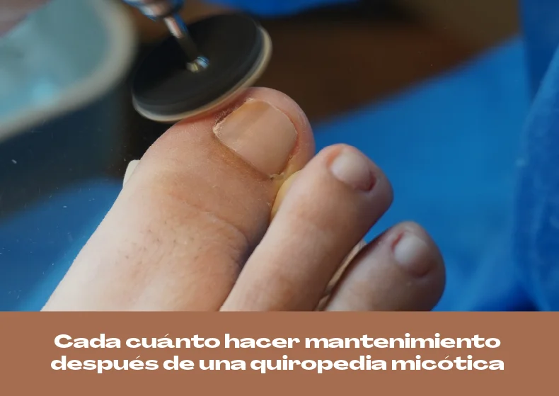 Cada cuánto hacer mantenimiento después de quiropedia micótica