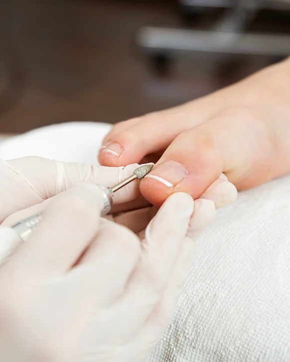 servicios-podologicos-lima-surquillo